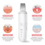 Ultrasonic Skin Care Spatula Vibration Blackhead Remover Cavitation Shovel Facial Exfoliation Skin Care Tools - Image 2