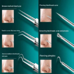 11Pcs Ingrown Hair Tweezers Acne Blackhead Removal Needles Black Dots Cleaner Pore Cleaner Deep Cleansing Face Skin Care Tools - Image 6