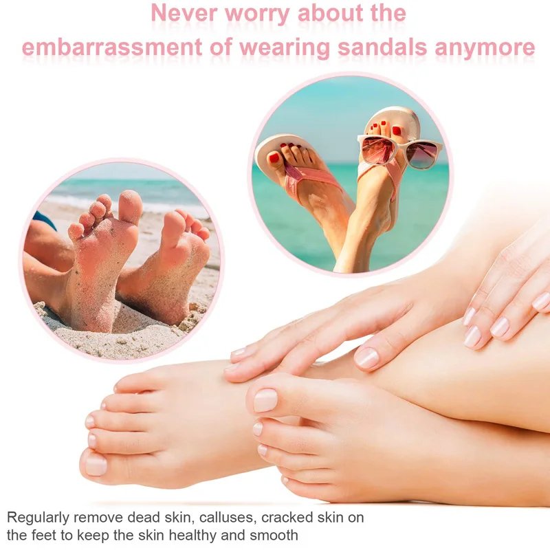 The Fast Rotating Electric Foot Grinder Comes With Replacement Sandpaper And An Electric Foot Grinder For Removing Calluses The Fast Rotating Electric Foot Grinder Comes With Replacement Sandpaper And An Electric Foot Grinder For Removing Calluses
